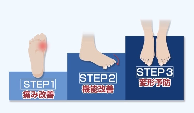 痛みの改善へ３ステップ