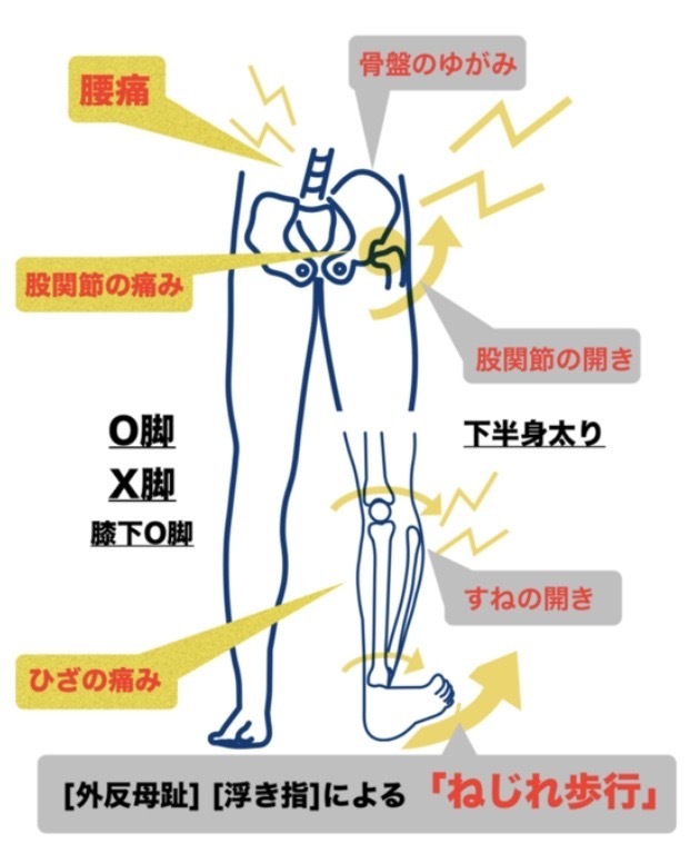 下半身太りの原因の説明