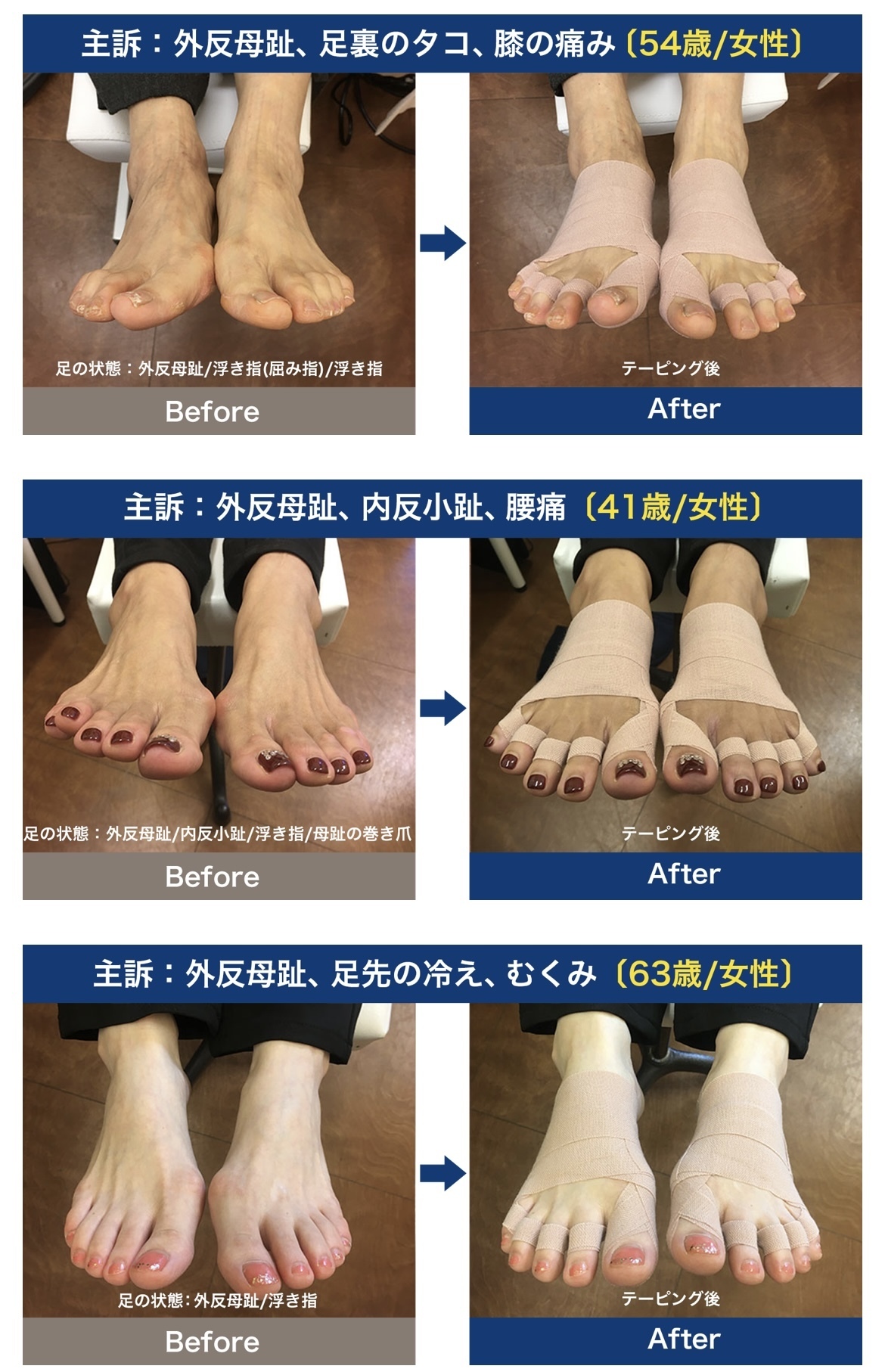 整足テーピングの説明