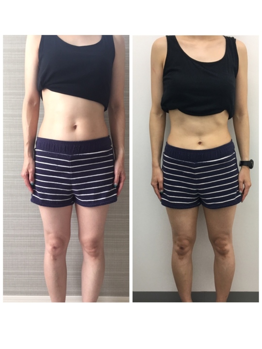 大和市40代女性・１週間ファスティングにチャレンジ