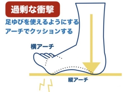 足ゆび付け根（足の裏）の痛み