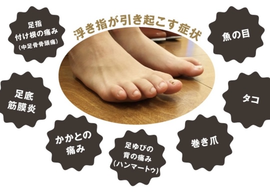 浮き指の足と浮き指が引き起こす症状の説明